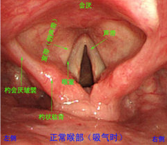 正常咽喉