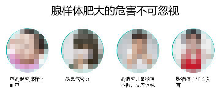 腺样体肥大的危害