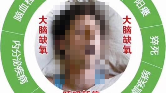 成都治疗打鼾的医院有哪些