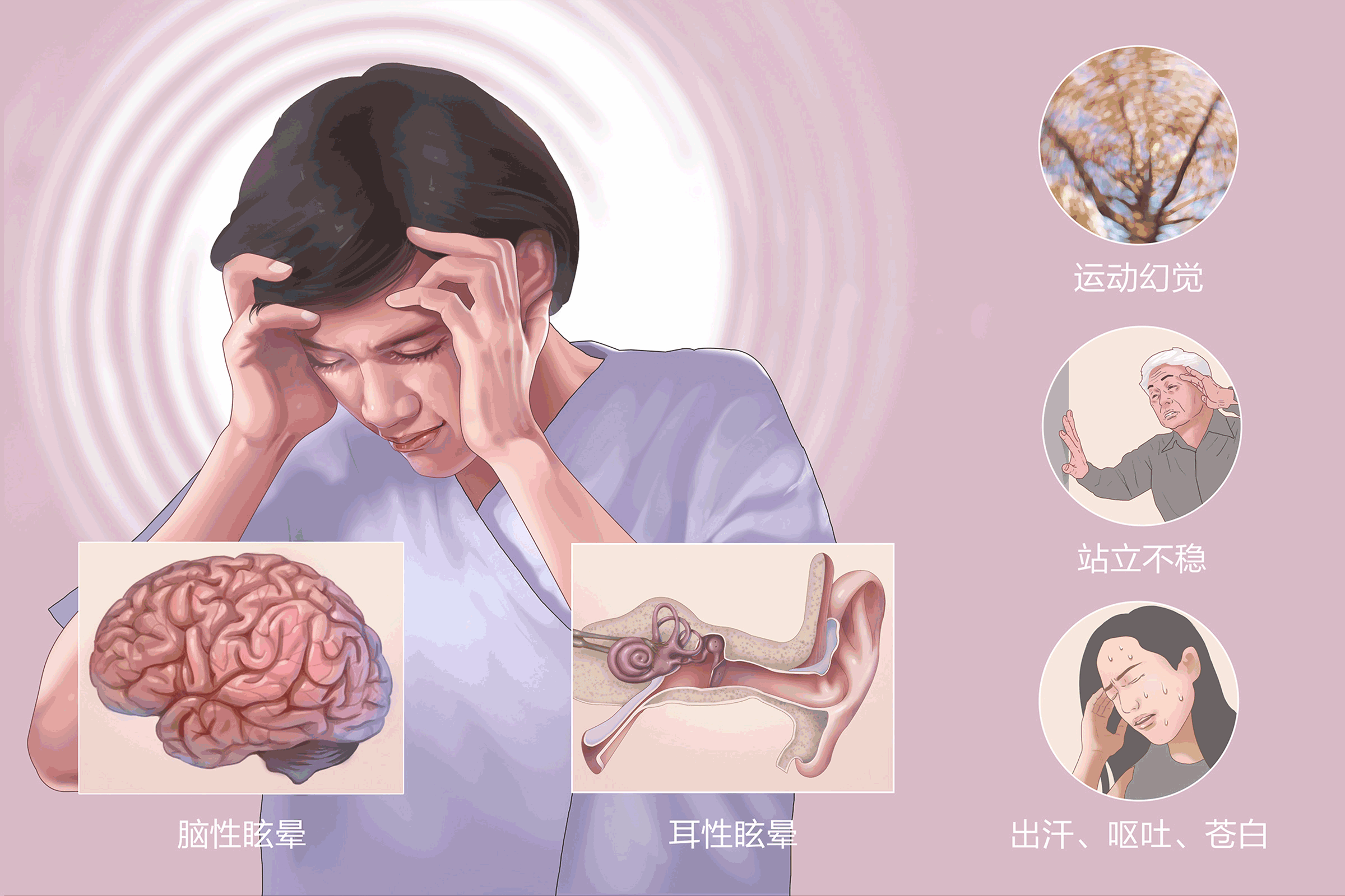 梅尼埃是什么病？导致的病因有哪些？